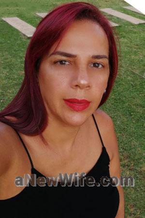 201876 - Teresa Age: 60 - Costa Rica